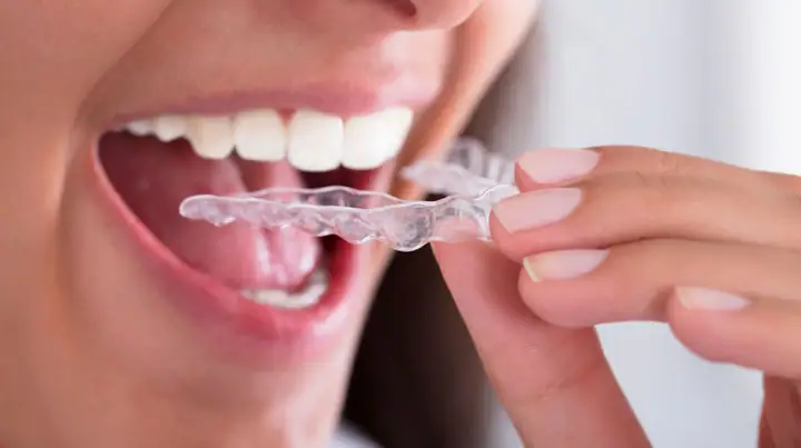 night-guard-for-teeth